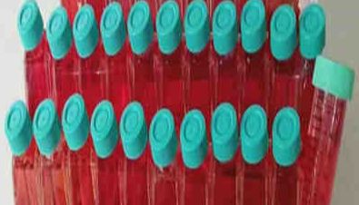 人宫颈上皮永生化细胞(H8)