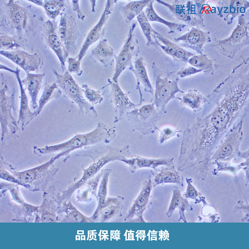 吞噬细胞功能检测实验，实验方法原理 