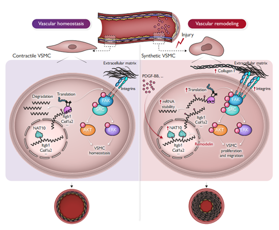 IF=37.6丨治疗血管重构相关疾病的新靶点发现