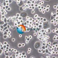 MDA-MB-453人乳腺癌细胞