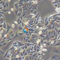 SW480 [SW-480]人结肠腺癌细胞