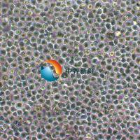 U-937人组织细胞淋巴瘤细胞