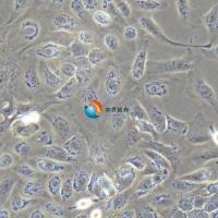 SK-OV-3人卵巢癌细胞
