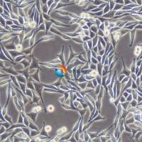 Lwnt-3a小鼠皮下结缔组织细胞