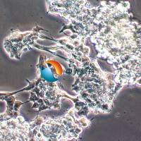 ZR-75-1人乳腺癌细胞