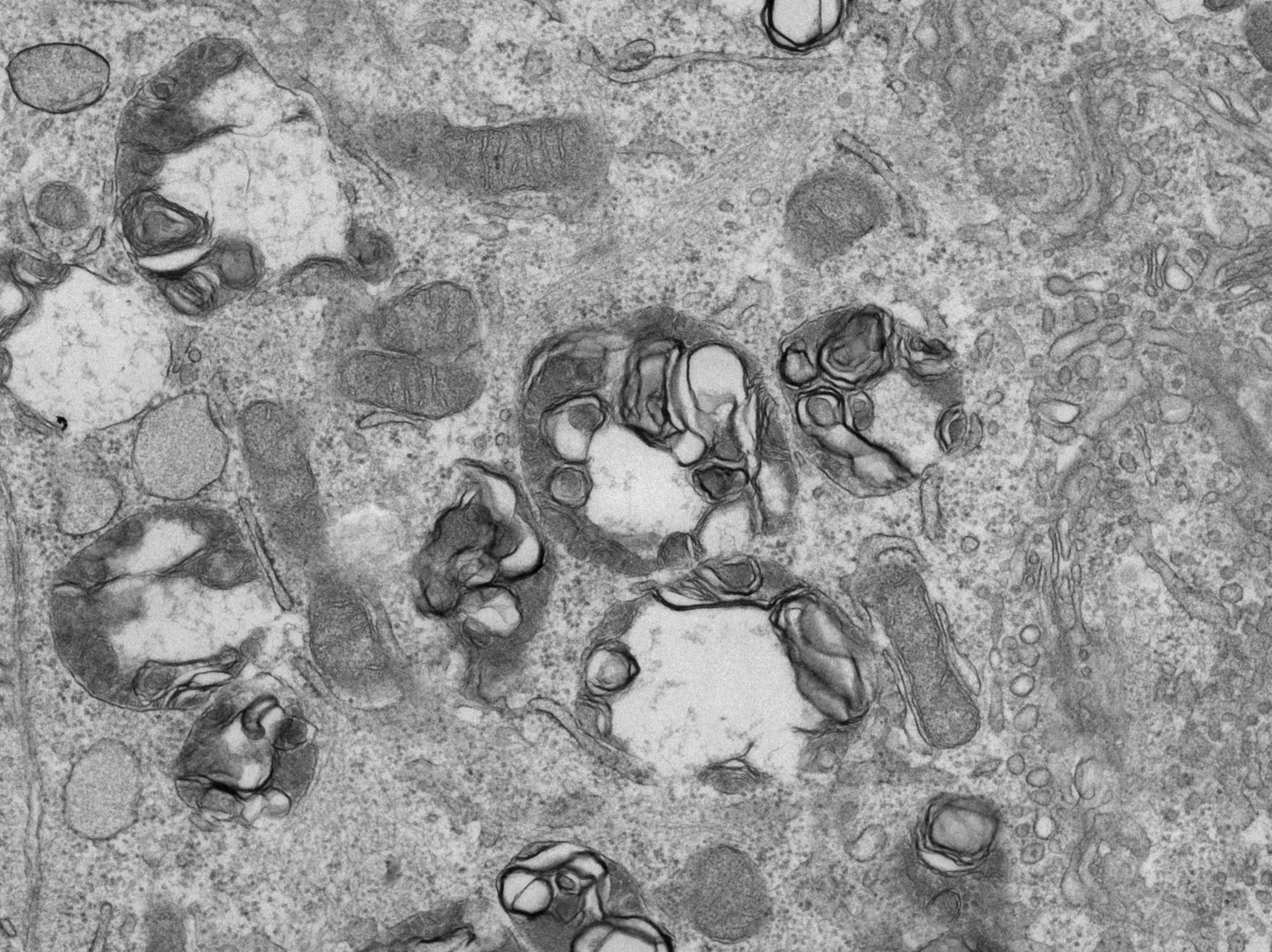 贴壁细胞透射电镜