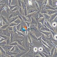 A2058人皮肤癌细胞