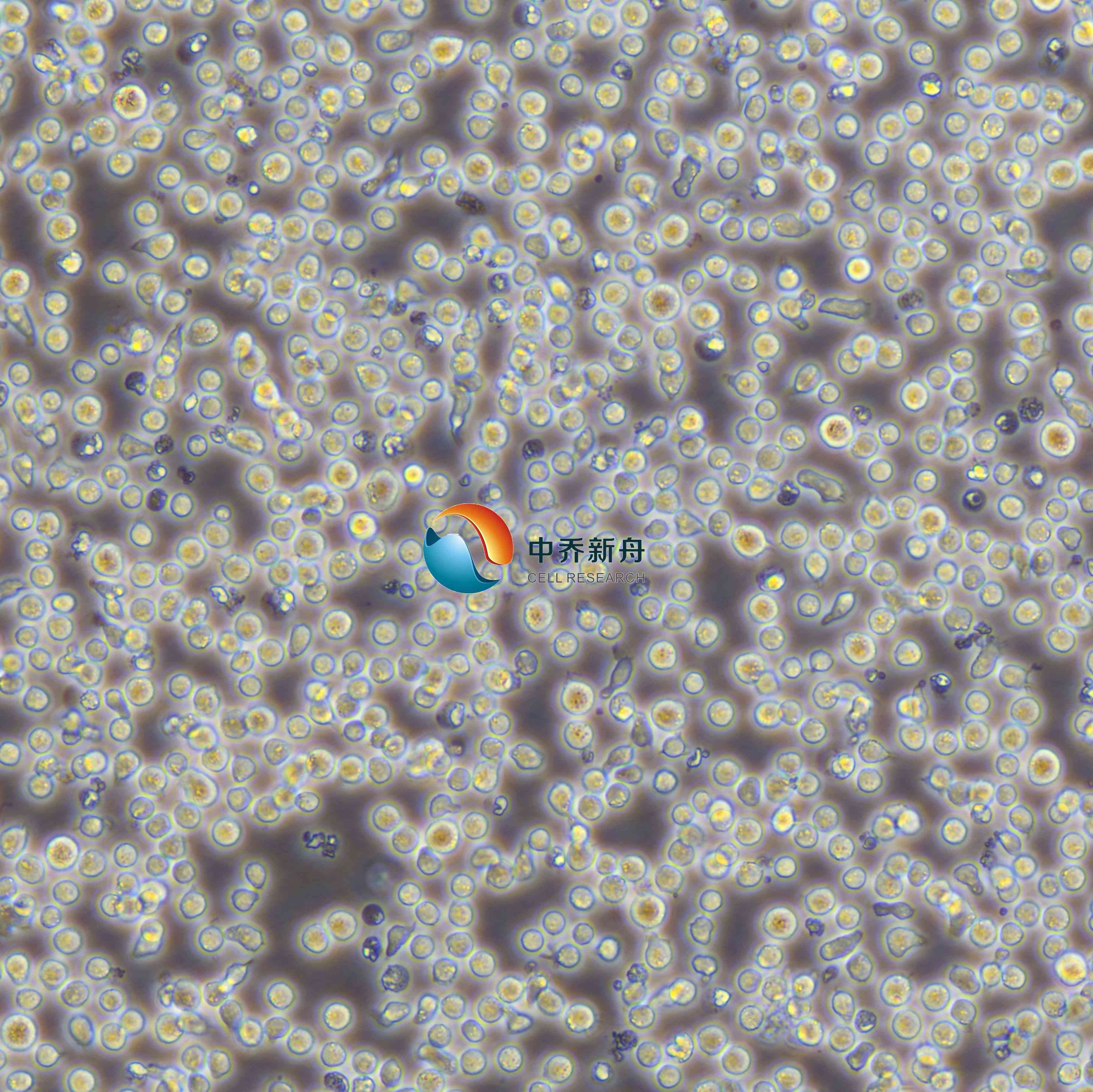 CCRF-CEM [CCRF CEM]人急性淋巴细胞白血病T淋巴细胞