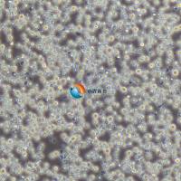 CCRF-CEM [CCRF CEM]人急性淋巴细胞白血病T淋巴细胞