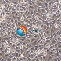 B16-F10小鼠黑色素瘤高转细胞