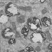 贴壁细胞透射电镜