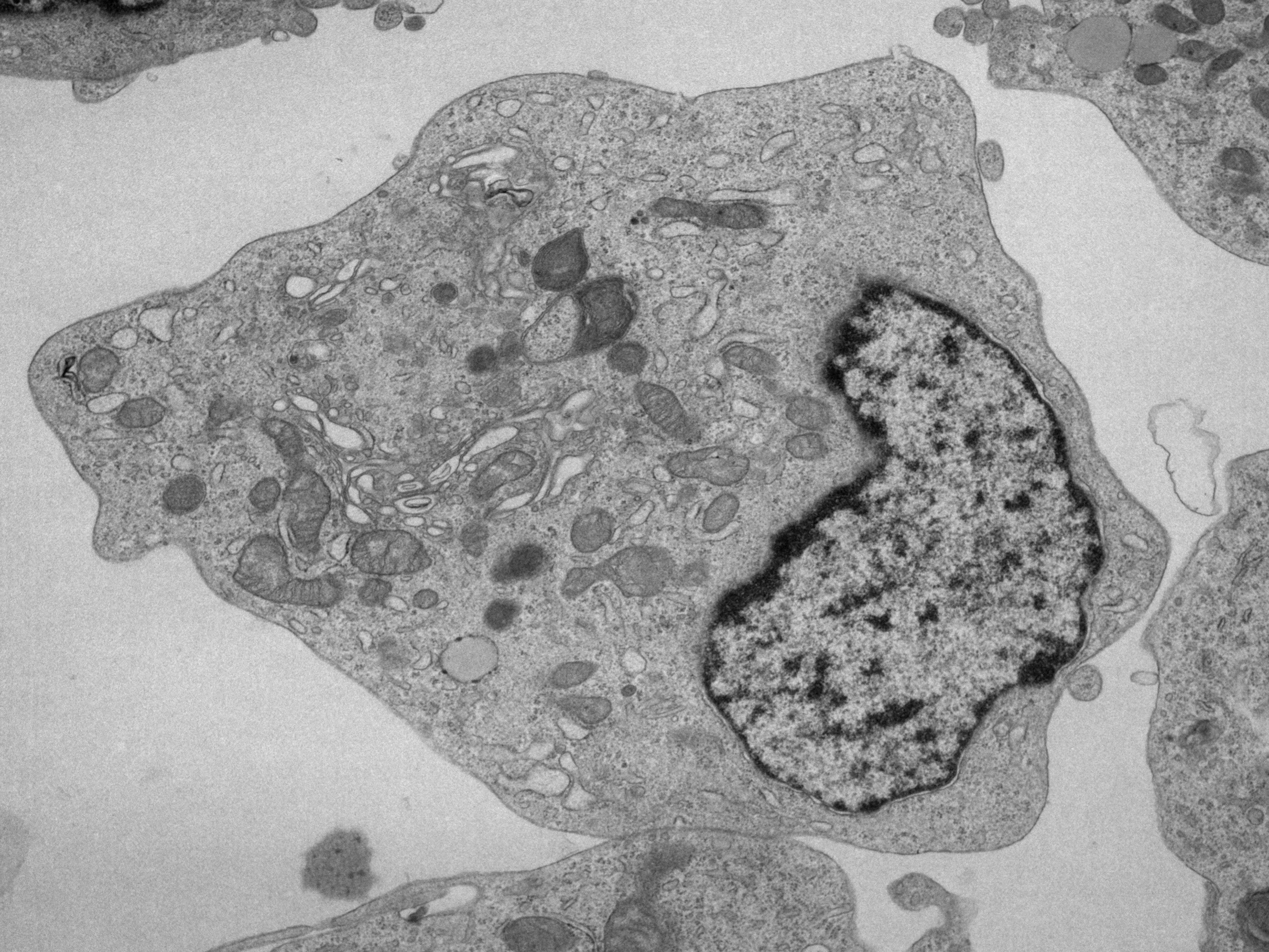 贴壁细胞透射电镜