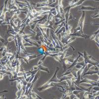 B16小鼠黑色素瘤细胞