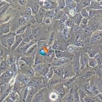 T-24人膀胱移行细胞癌细胞