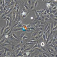 U-2OS人骨肉瘤细胞