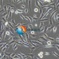 MDA-MB-231人乳腺癌细胞