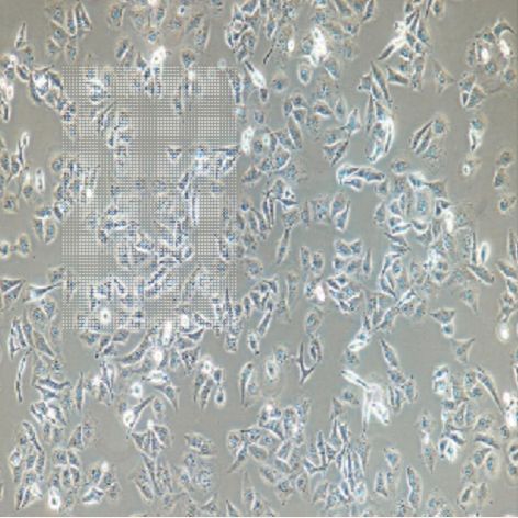 唐菖蒲伯克霍尔德氏菌生化鉴定试剂盒