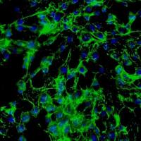 人甲状腺成纤维细胞