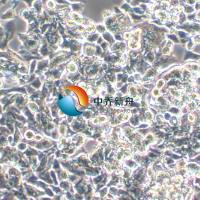 LS 174T人结肠腺癌细胞