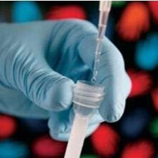 NAV1.7蛋白抗原,电压门控钠通道蛋白抗原