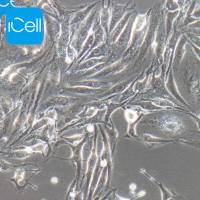 bEnd.3+RFP、bEnd.3/RFP细胞、bEnd.3细胞、 小鼠脑微血管内皮细胞红色荧光标记