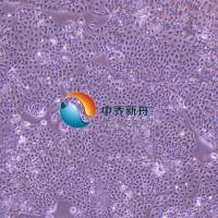 HuH-6人肝母细胞瘤细胞