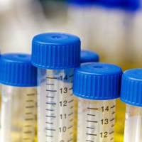 青霉素-链霉素混合溶液（100×双抗）