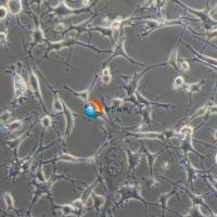 K7M2 wt [K7M2-WT]小鼠骨肉瘤成骨细胞