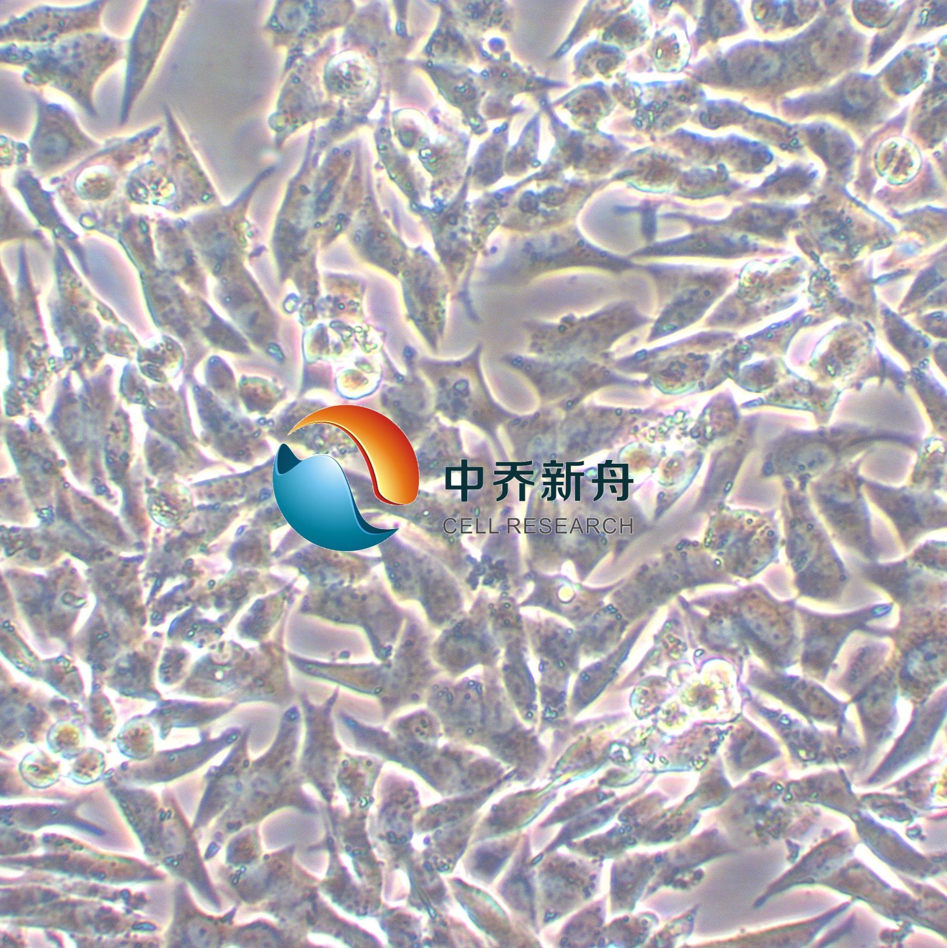 TT人甲状腺导管癌细胞