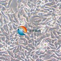 TT人甲状腺导管癌细胞