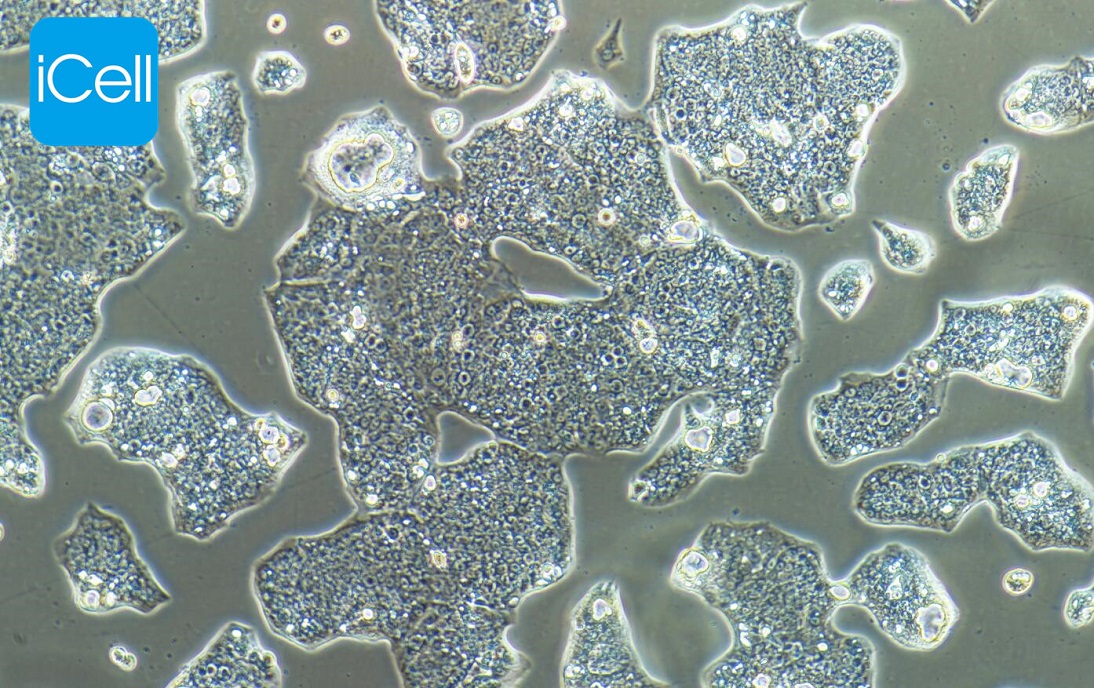 NCI-N87 |NCI-N87细胞|NCI-N87|NCI