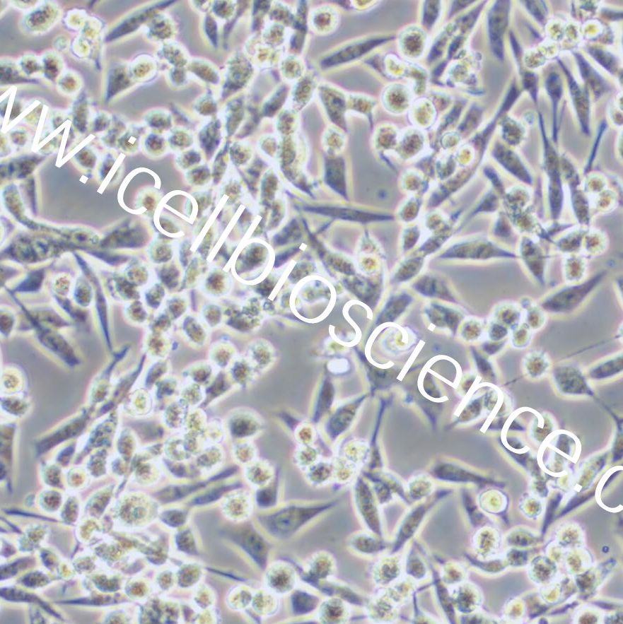 E0771、E0771细胞、E-0771细胞、E-0771、小鼠髓样乳腺癌细胞/镜像绮点(Cellverse)