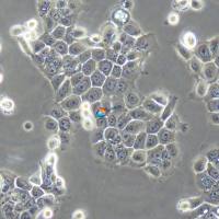 Eca-109人食管癌细胞