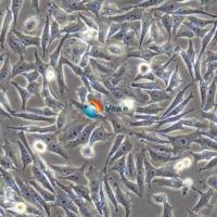 HGC-27人胃癌细胞（未分化）