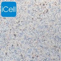 Sp2/O-Ag14 |Sp2/O细胞|Sp2/O|Sp2/O-Ag14细胞|Sp2/OAg14|Sp2/O|小鼠骨髓瘤细胞/STR鉴定/镜像绮点(Cellverse)