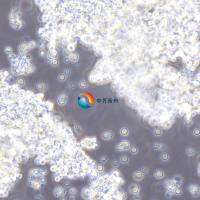 AtT-20小鼠垂体瘤细胞