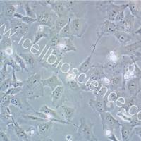 HCC38、HCC38细胞、HCC-38细胞、HCC-38、乳腺导管癌细胞/STR鉴定