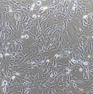 HUVEC细胞专用培养基