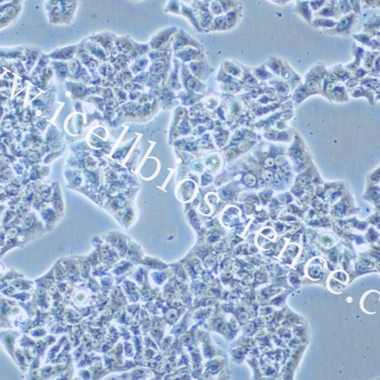 HCC1954、HCC1954细胞、HCC-1954细胞、HCC-1954、人乳腺导管癌细胞/STR鉴定