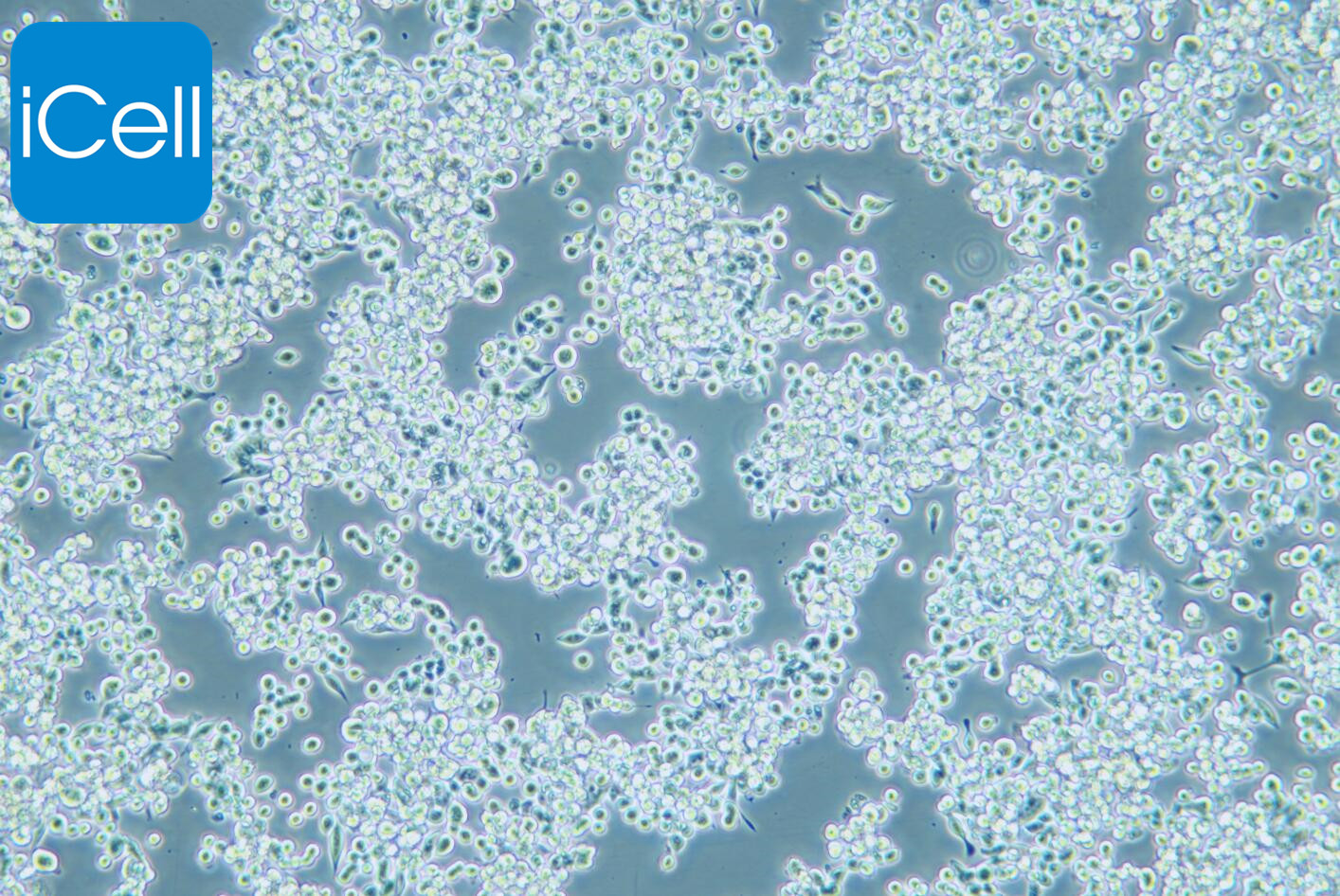 MKN-45、MKN-45细胞、MKN45细胞、MKN45人