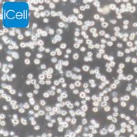 U266 | U266细胞 | U-266细胞 | U-266 | 人骨髓瘤细胞 | STR鉴定 | 镜像绮点（Cellverse）