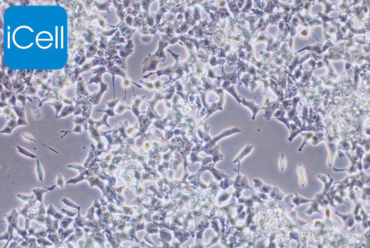 INS-1、INS-1细胞、INS1细胞、INS1、大鼠胰岛
