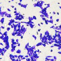 Transwell迁移/侵袭