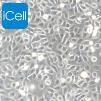 5637、5637细胞、5637细胞、人膀胱癌细胞/STR鉴定/镜像绮点(Cellverse)