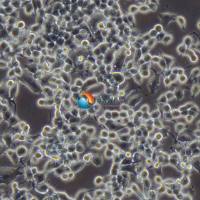 Neuro-2a [N2a; Neuro-2a]小鼠脑神经瘤细胞