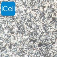 SW620、SW620细胞、SW-620细胞、SW-620、人结直肠腺癌细胞/STR鉴定/镜像绮点(Cellverse)