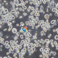 KATO III人胃癌细胞