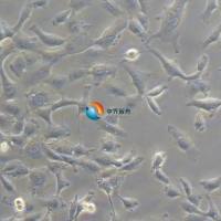 HT-1080人纤维肉瘤