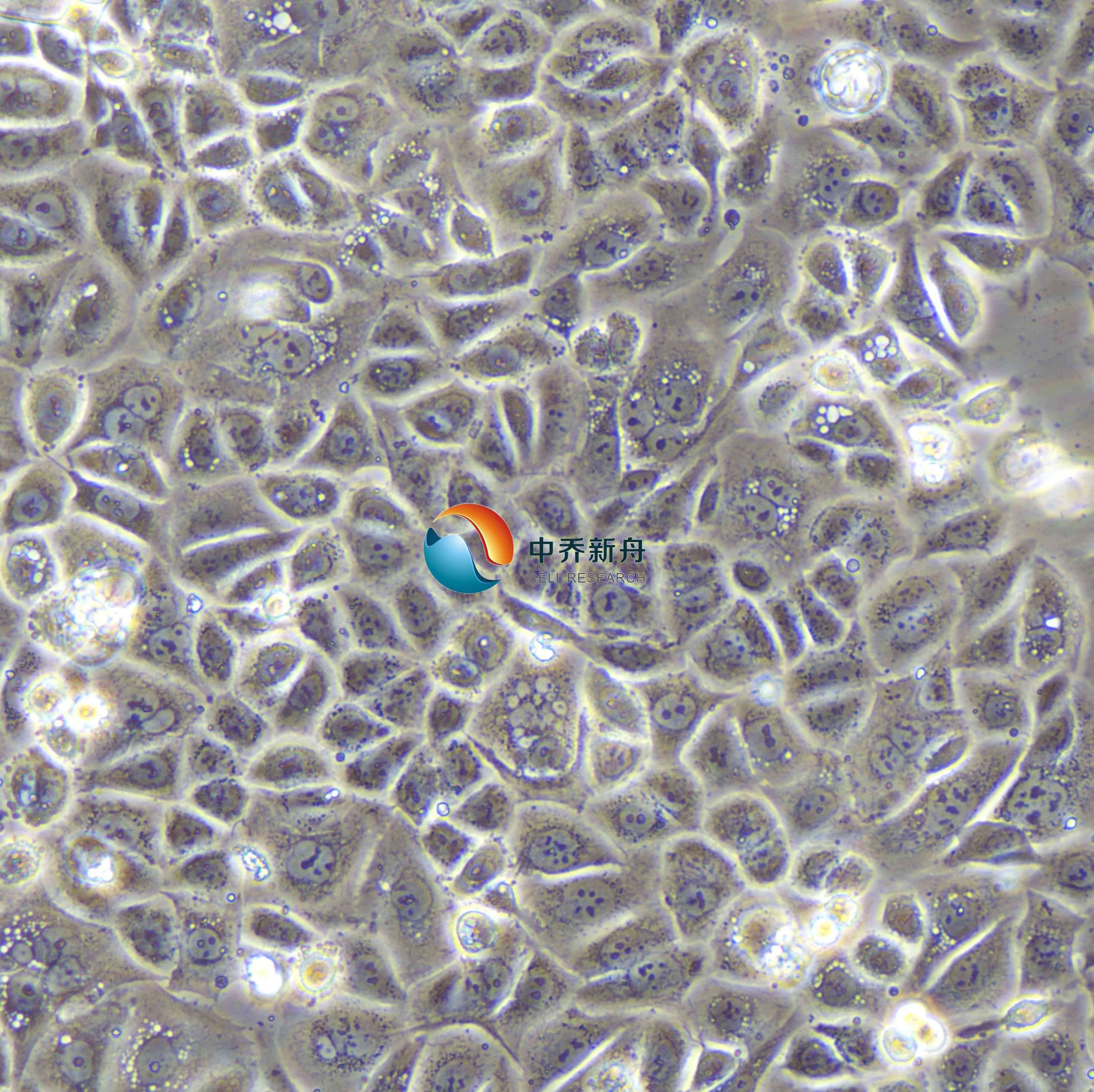 AGS人胃腺癌细胞