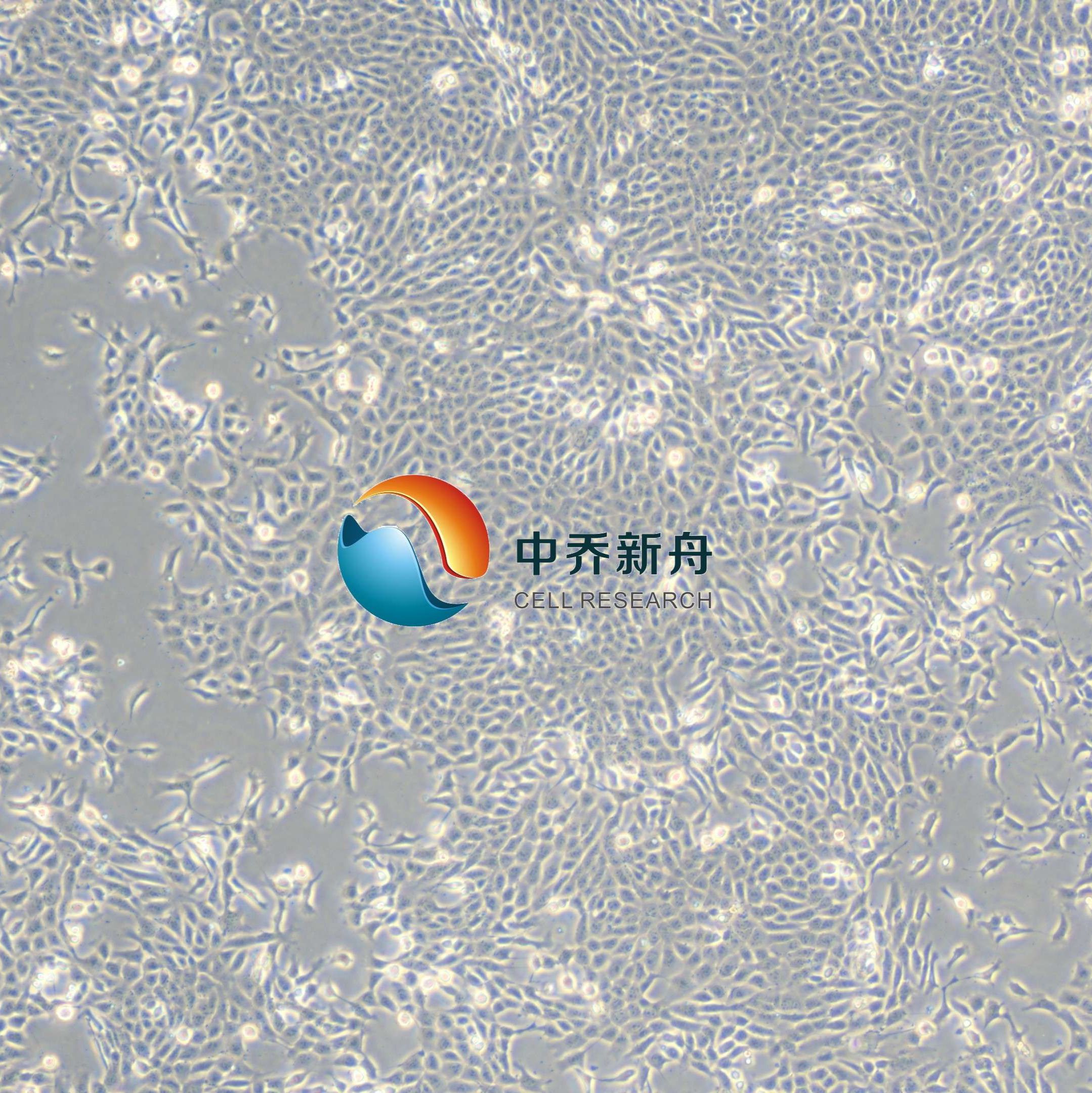 4T1小鼠乳腺癌细胞